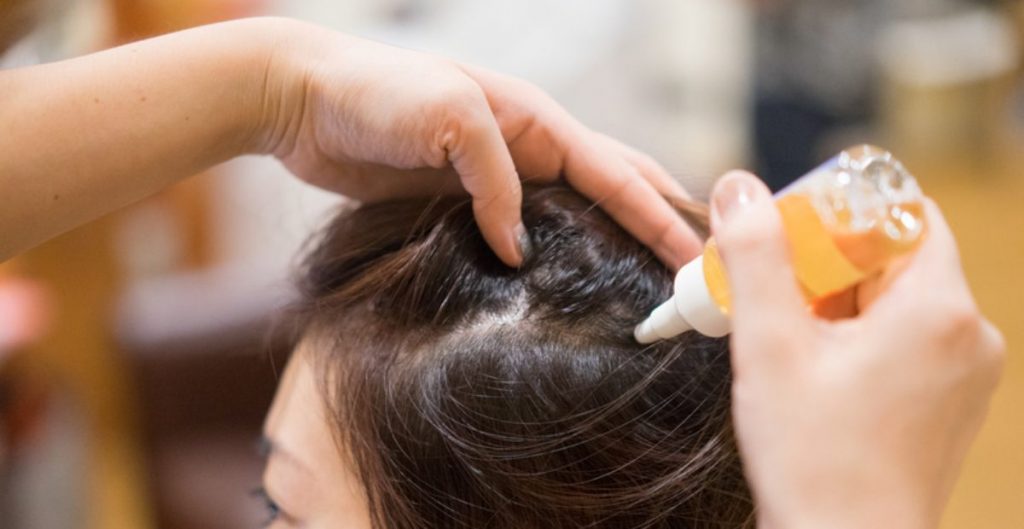 Beragam Manfaat Hair Tonic yang Perlu Anda Ketahui